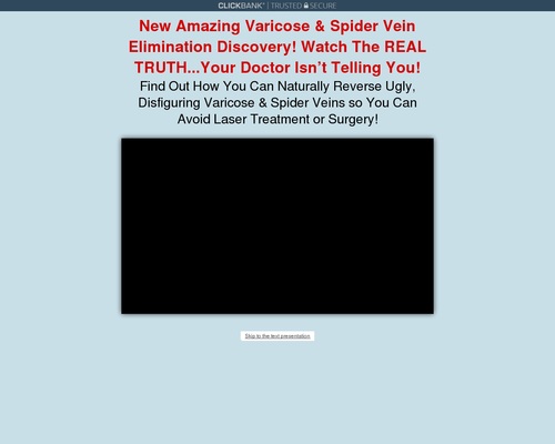 Varicose Veins Natural Treatment | Varicose Veins Home Treatment Program post thumbnail image